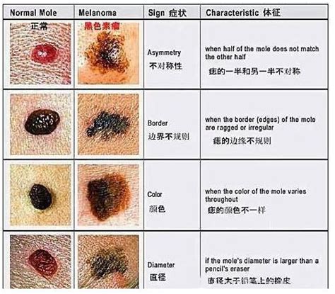 腰間痣|腰上有這顆痣的人天生財運佳，命里藏金，家財萬貫